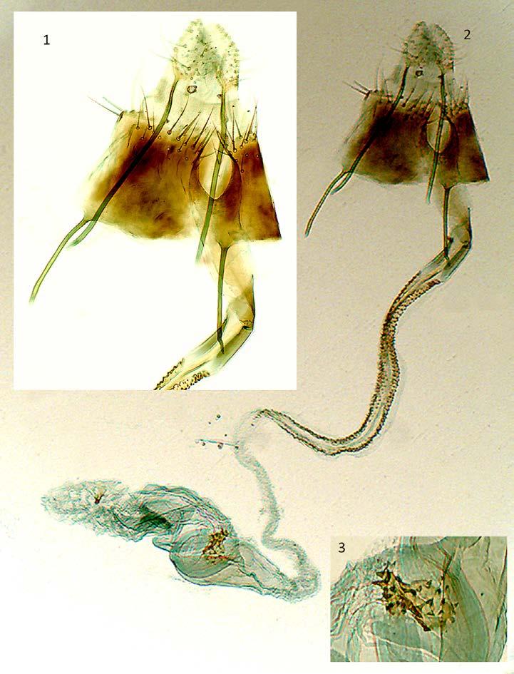 220 T. RYNARZEWSKI, U. WALCZAK Fig. 1 3. Female genitalia of Coleophora chrysanthemi HOFMANN (phot. T. RYNA- RZEWSKI). 1 ovipositor, sterigma and colliculum enlarged. 2 ventral aspect.