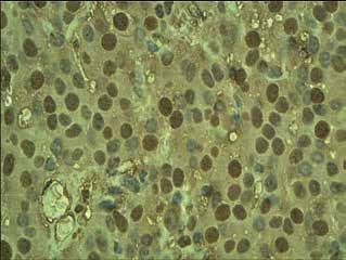Endokrynologia Polska 2014; 65 (5) Introduction Prothymosin alpha (ProTα) is a peptide consisting of 111 amino acid residues.