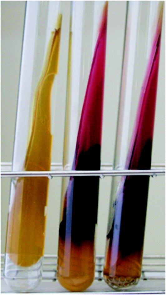 W zwi¹zku z charakterem wzrostu na MSRV za celowe uznano dodatkowy posiew na Salmonella Chromogenic Medium II (Oxoid) oraz test ID32E (bio- Merieux).