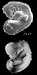 anatomicznie nieodróżnialne