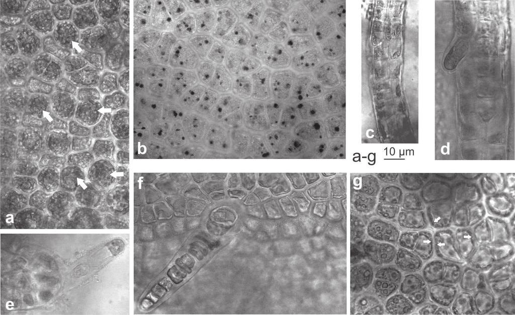 316 Fragm. Florist. Geobot. Polon. 23(2), 2016 Ryc. 4. Budowa anatomiczna Ulva flexuosa subsp.