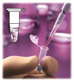 mikrosatelitarnych (SSR) i (PCR-RFLP) Analizowany materiał: