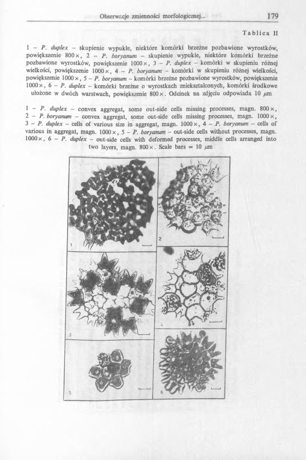 Tablica II 1 - P. duplex - skupienie wypukłe, niektóre komórki brzeżne pozbawione wyrostków, powiększenie 800 x, 2 - P.