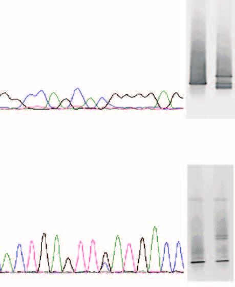 Hematologia 2010, tom 1, nr 3 Dyskusja Rycina 1.
