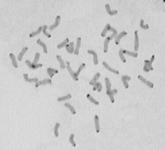 chromosomów.