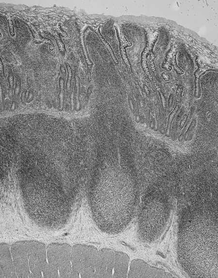 Panetha Gruczoły dwunastnicze produkują: zasadowy płyn bogaty w wodorowęglany