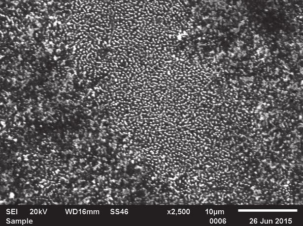 Another negative factor which limits the use of titanium alloys in medicine is insufficient abrasion resistance of these materials.