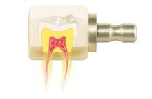Zalety produktu Właściwości podobne do naturalnego zęba: VITA ENAMIC charakteryzuje się ścieralnością podobną do abrazji