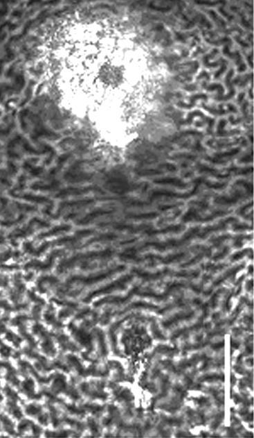 0 µm) cysty Globodera rostochiensis Fig.