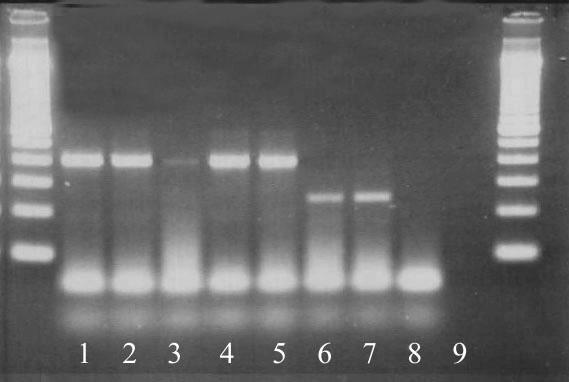 Progress in Plant Protection 55 (3) 205 259 Rys. 5. Rozdział elektroforetyczny produktów reakcji PCR (metoda według Zouhara i wsp.