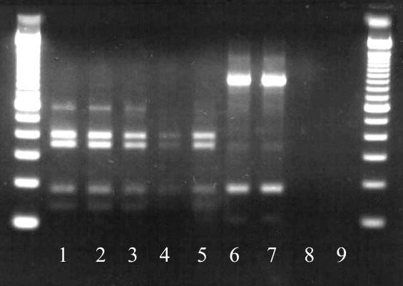 odczynnikowa, bez matrycy DNA), 9 kontrola negatywna elektroforezy (woda).