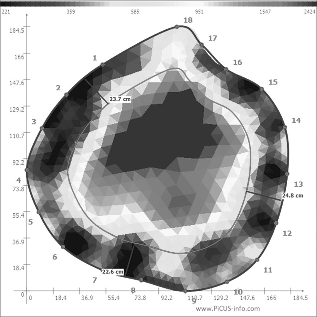 Diagnozowanie kondycji drzew z wykorzystaniem tomografii komputerowej 77 Ryc. 4. Przykładowy tomogram przekroju poprzecznego pnia dębu szypułkowego (Quercus robur L.