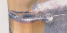 Tool wear small cutting edge chipping leading to poor surface texture and excessive flank wear. Cause cutting edge too brittle. Insert edge too weak. Builtup edge has been formed.