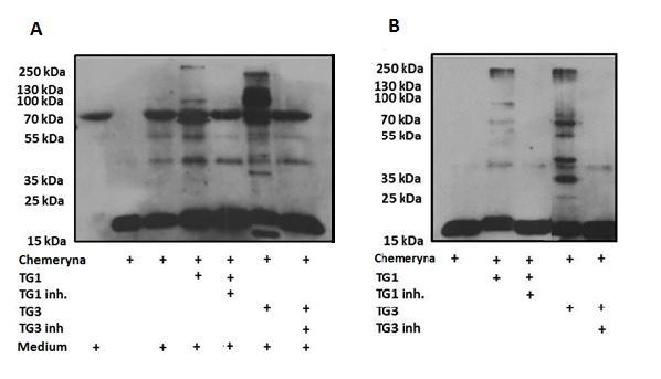 rekombinowaną chemerynę inkubowano w obecności medium z hodowli ludzkich keratynocytów, transglutaminaz oraz inhibitorów transglutaminaz.