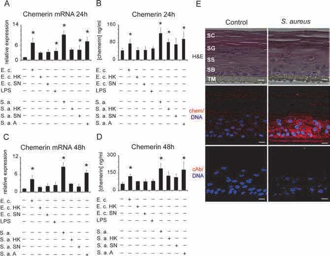 Chemerin Regulation in Epidermis Fig 4. Bacteria upregulate chemerin expression in epidermis. Keratinocytes were treated with the indicated factors for 24 (A, B, E) or 48h (C, D).
