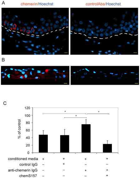 Chemerin in Epidermis Figure 1. Keratinocyte-derived chemerin displays anti-bacterial activity.