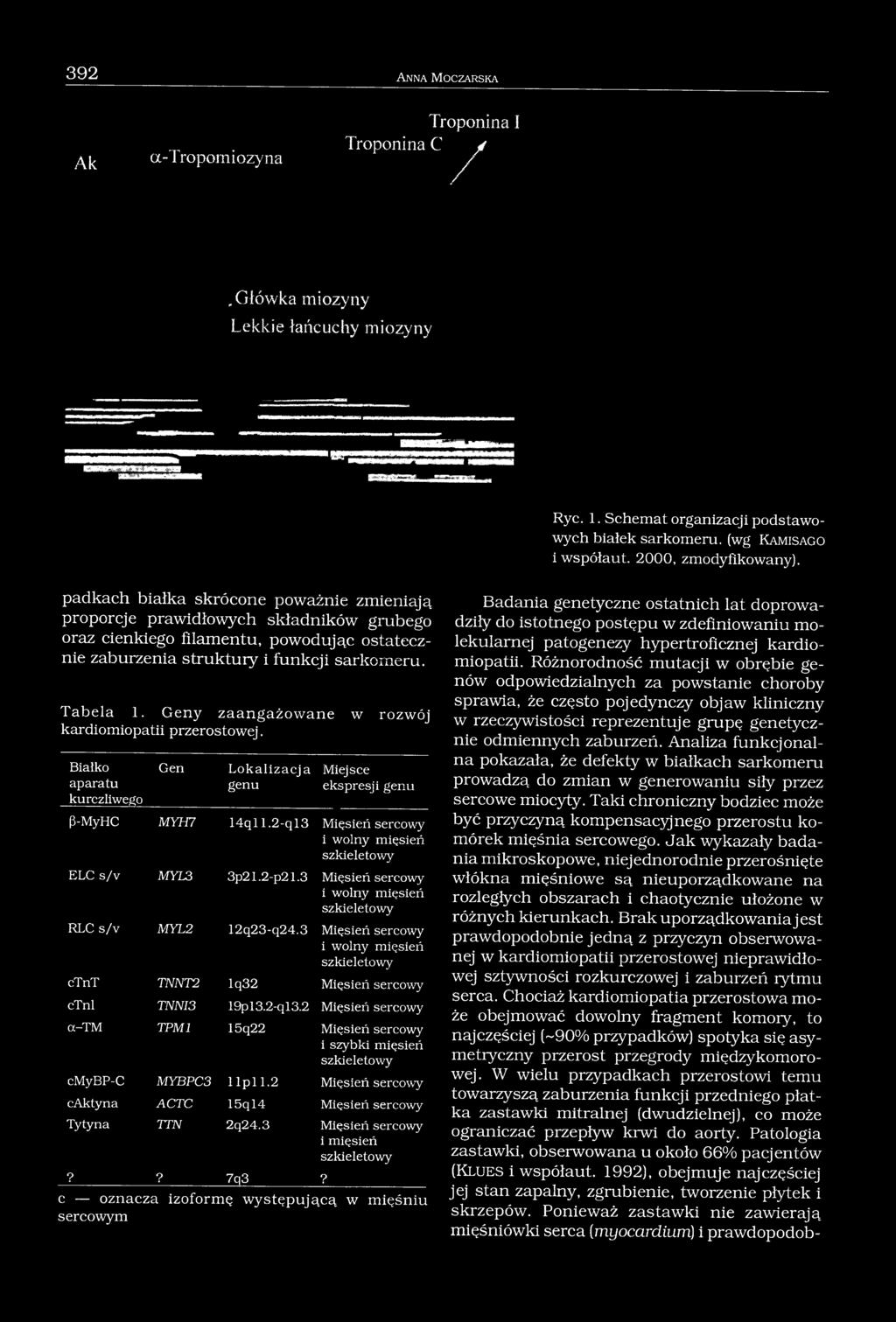 padkach białka skrócone poważnie zmieniają proporcje prawidłowych składników grubego oraz cienkiego filamentu, powodując ostatecznie zaburzenia struktury i funkcji sarkomeru. Tabela 1.