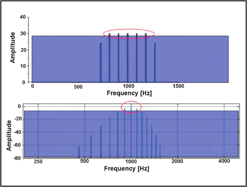 słuchu pomiędzy 60 a 80 db nhl. U trojga dzieci stwierdzono niedosłuch stopnia głębokiego (90 db nhl). U dwóch pacjentów nie zarejestrowano odpowiedzi (Ryc. 3). Omówienie Ryc.