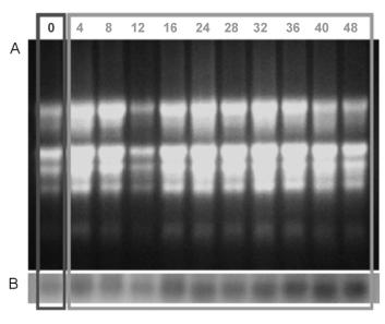 EKSPRESJA GENU AKWAPORYNY W SIEWKACH Pharbitis. nil... 479 Rys. 1. Fig. 1. Wynik hybrydyzacji northern pokazujący zmiany ekspresji genu PnPIP1 w liścieniach roślin uprawianych w ciemności.