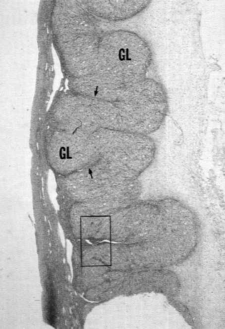 ziarnisto-luteinowe. 3.