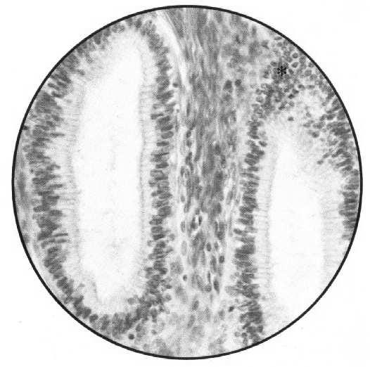licznymi komórkami wydzielającymi śluz podłużne fałdy błony śluzowej i