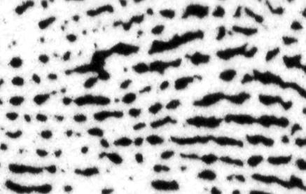 Odbitka linii papilarnych wielkiego palca lewej rêki z karty sporz¹dzonej z u yciem poduszki tuszowej odcinek Fingerprint of left hand thumb from TP made with ink method island (short ridge) Odbitka