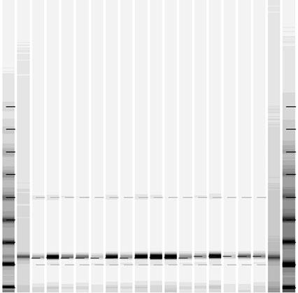uzyskanych analizowanych drzew izolatów Borytis cinerea Pers. 3 7 Chaetomium globosum Kunze 7 15 Cladosporium herbarum Pers. Link 2 5 Fusarium equiseti (Cda) Sacc.
