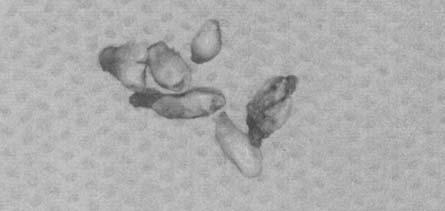 odontogenezy.