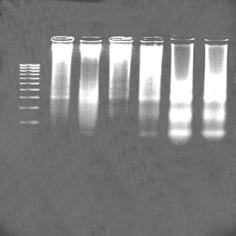 WYNIKI 100 A B C _ 1 2 1 2 1 2 + _ + Rycina 41. Aktywacja synaptozomalnego czynnika wywołującego degradację DNA jądrowego przez Aβ 25-35.
