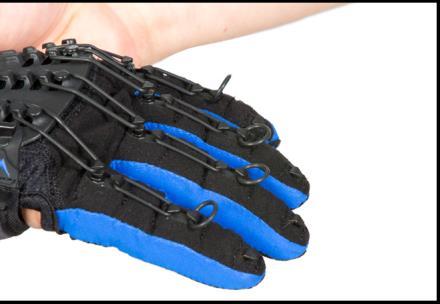 Zdejmowanie SaeboGlove Fig 22: