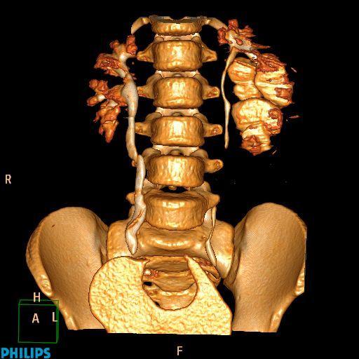 UROGRAFIA