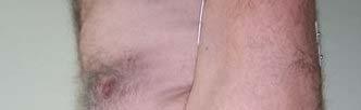 Collation of muscle groups participating in measurements according to type of performed movement Rotacja wewnętrzna i zewnętrzna Internal and external rotation 1 mięsień podgrzebieniowy 1 Musculus
