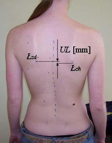 Physiotheraphy 2008, 16, 1 Jarosław Skolimowski, Ewa Demczuk-Włodarczyk, Beata Skolimowska, Sławomir Winiarski... Treatment proceeding persons with shoulder pain syndrome 25 20 15 N 10 5 Ryc. 4.