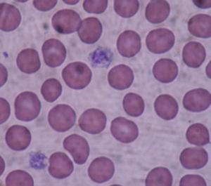Trombocyty Trombocyty: podłużna komórka pozbawiona jądra mniejszy od pozostałych komórkowych składników krwi człowieka powstają w wyniku oderwania się fragmentów cytoplazmy megakariocytów zawierają