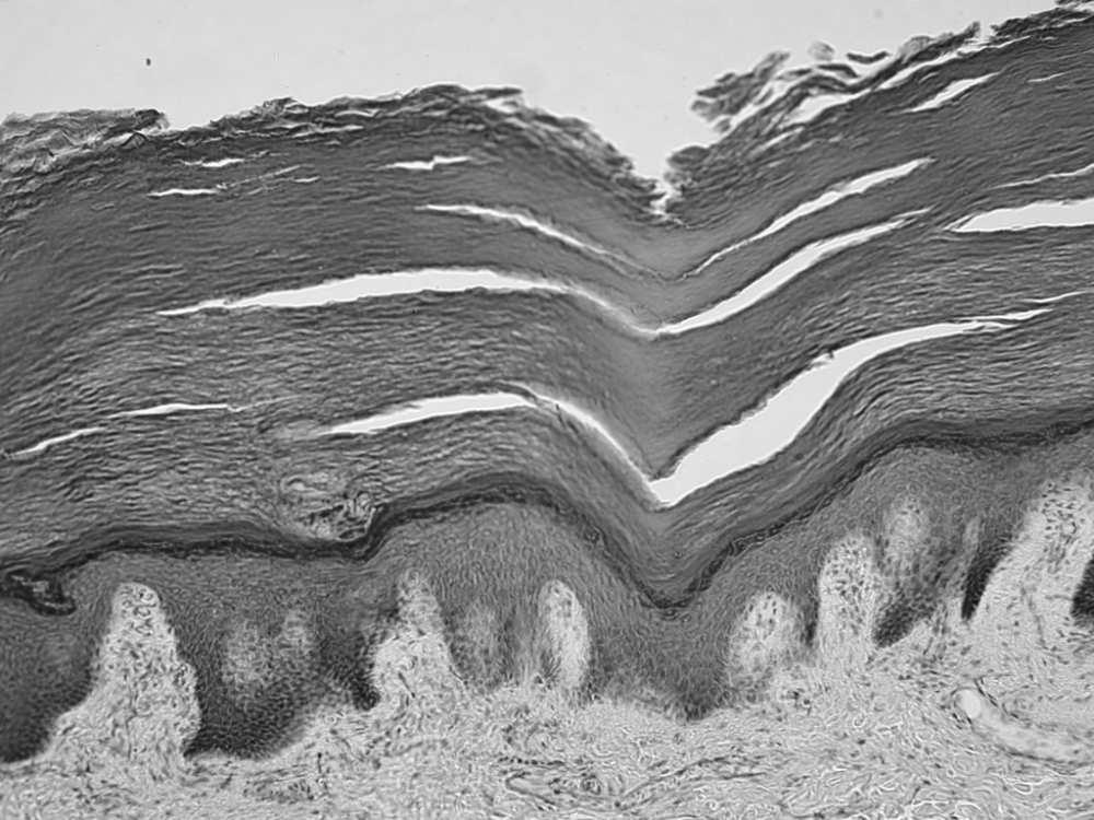 Keratynocyty w naskórku układają się w warstwy w. zrogowaciała w.