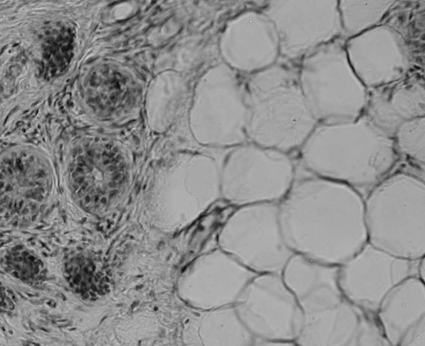 keratynosomów strefy zamykające łączące keratynocyty warstwy ziarnistej Tkanka podskórna: -