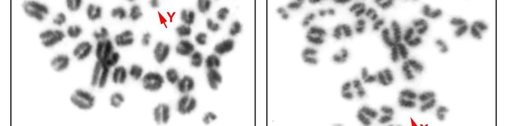 Giemsa stained metaphase chromosomes of aoudad: 58,XY (A),
