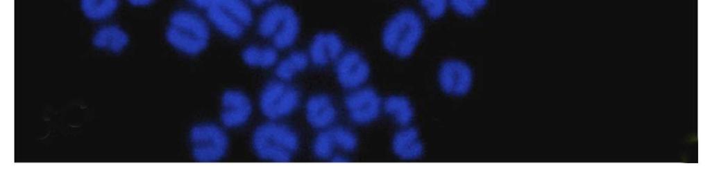Chromosomy metafazowe barwione barwnikiem Giemsy: 58,XY (A), 
