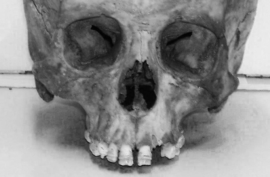 HEALTH AND WELLNESS 4/2014 Wellness and society Macroscopic analysis is usually focused on the quantitative indicators of physiological stress detectable on the surface of tooth crowns in the form of