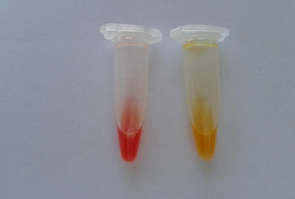 Mikrobiologia Wykrywanie karbapenemaz Szczepy pałeczek Gram-ujemnych wytwarzające karbapenemazy nagminnie wykazują tzw. wielooporność, czyli niewrażliwość na co najmniej trzy grupy leków (ang.