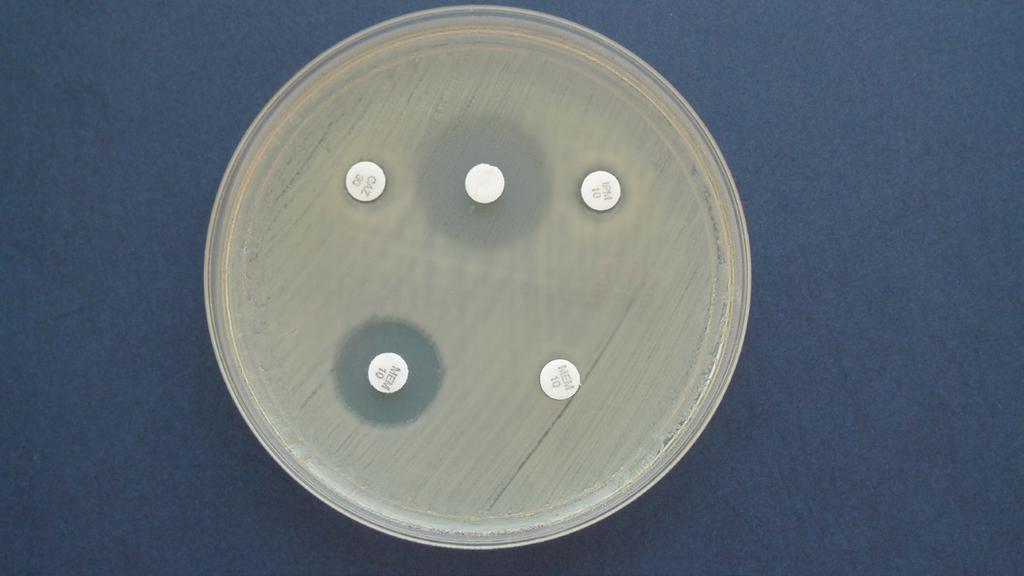 : extensively drug-resistant, XDR), a pojawiają się też wśród nich już szczepy oporne na wszystkie dostępne obecnie leki (ang.: pandrug-resistant, PDR).