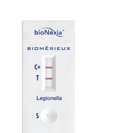 Legionella pneumophila w ciągu 3,5