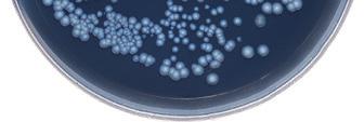 Legionellaella Wykrywanie antygenu