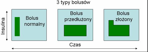 Nowoczesne technologie w terapii cukrzycy typu 1 ZASADA DZIAŁANIA POMPY INSULINOWEJ Pompa poruszana jest przez silnik mechaniczny zasilany baterią.