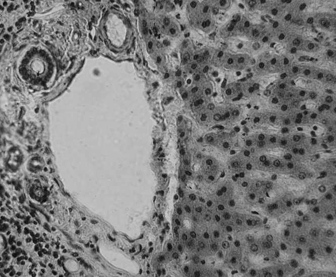 wątrobowego: 1 bogata w tlen (aktywnego metabolizmu) 2 pośrednia (zmiennego metabolizmu) 3