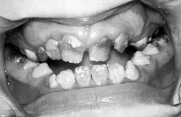 442 A. GRZYBOWSKA et al. Ryc. 7. Pacjent K. D.