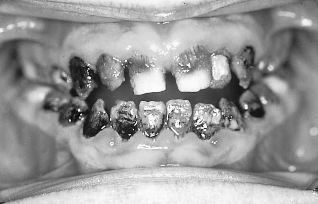 clinical view Ryc. 11. Pacjent K. L.