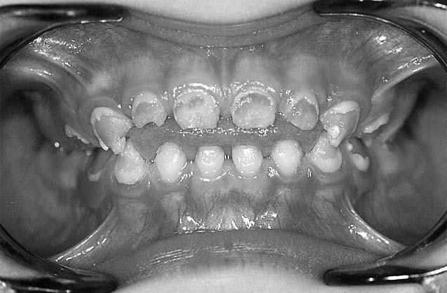 clinical view Ryc. 8. Pacjent K. D.