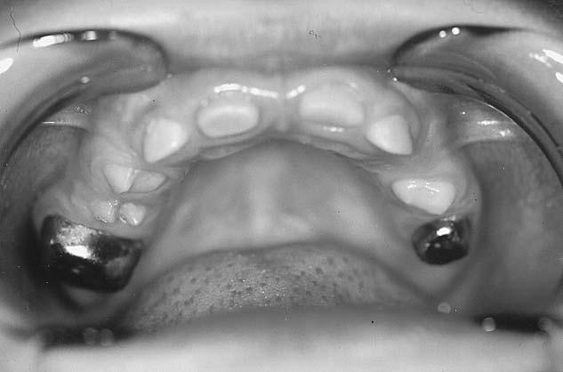 clinical view Ryc. 13. Pacjent K. L.