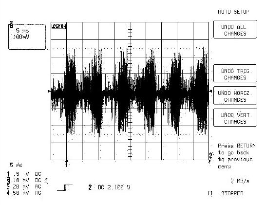 3.3. Brak obrazu z tunera telewizyjnego Czy na pinie 2 filtru SAW FT700 (X6965) pojawia siê sygna³ pokazany na oscylogramie 5?